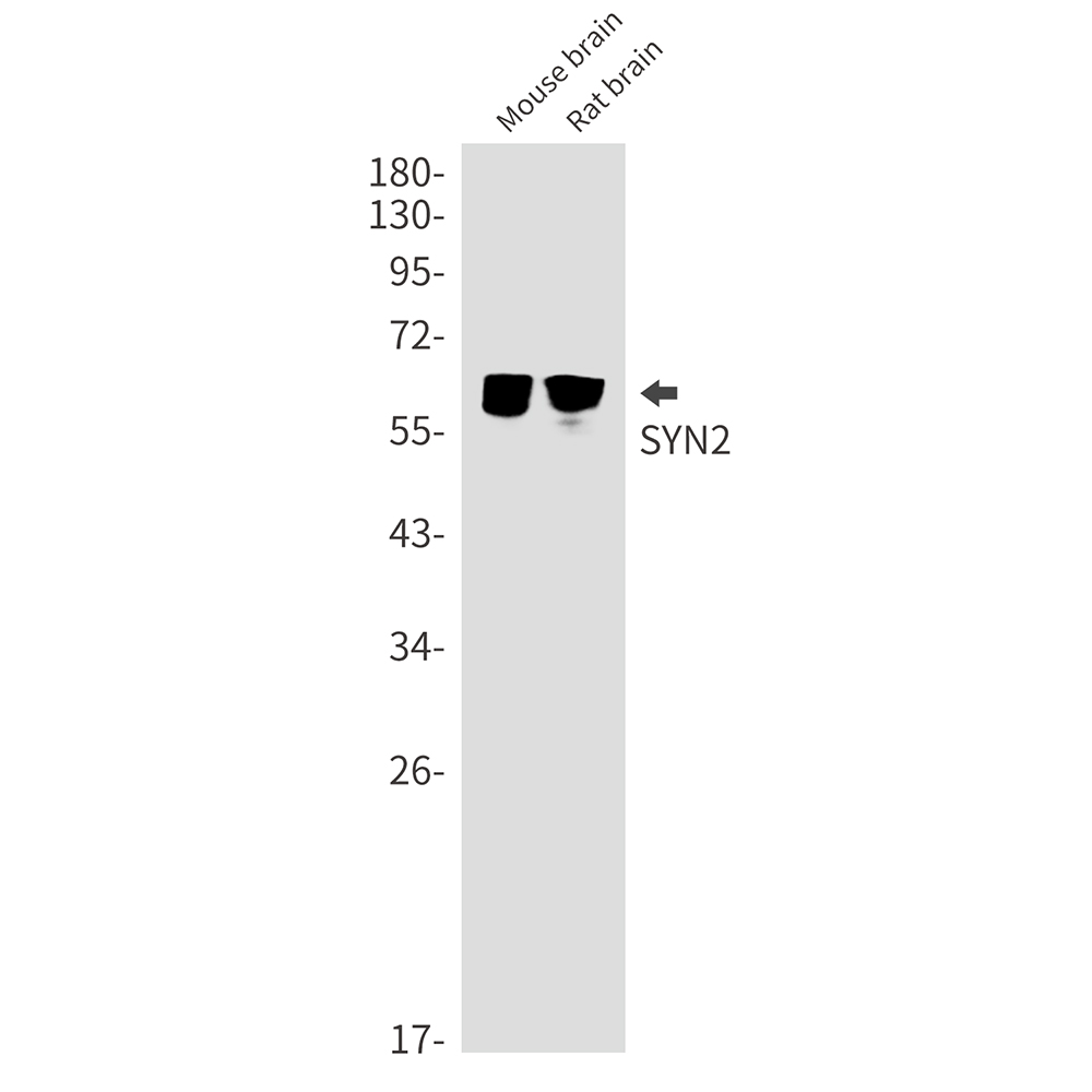 Synapsin 2 Rabbit mAb