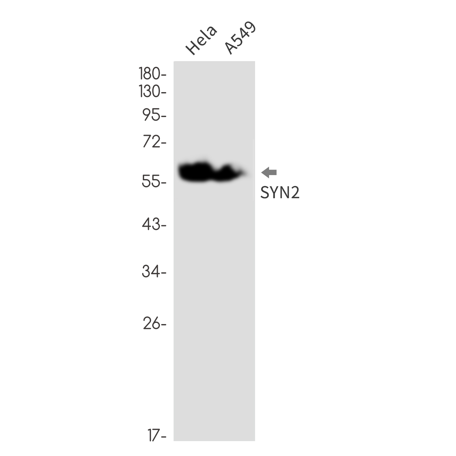 Synapsin 2 Rabbit mAb