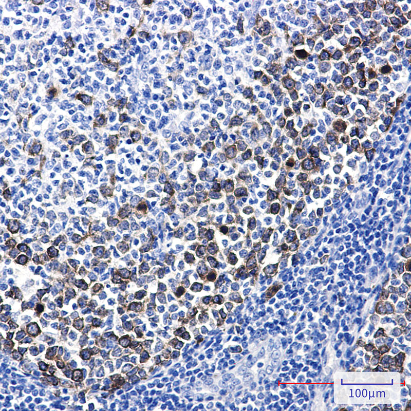 TACC3 Rabbit mAb