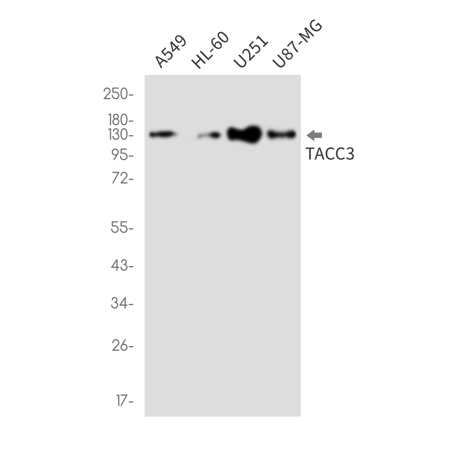 TACC3 Rabbit mAb