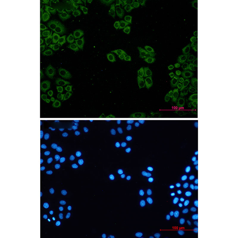 TCP 1 alpha Rabbit mAb