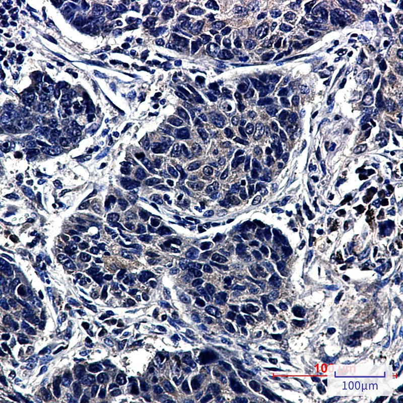 TCP 1 alpha Rabbit mAb