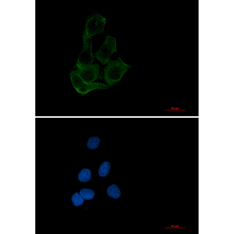 Transcription Factor EB Rabbit mAb