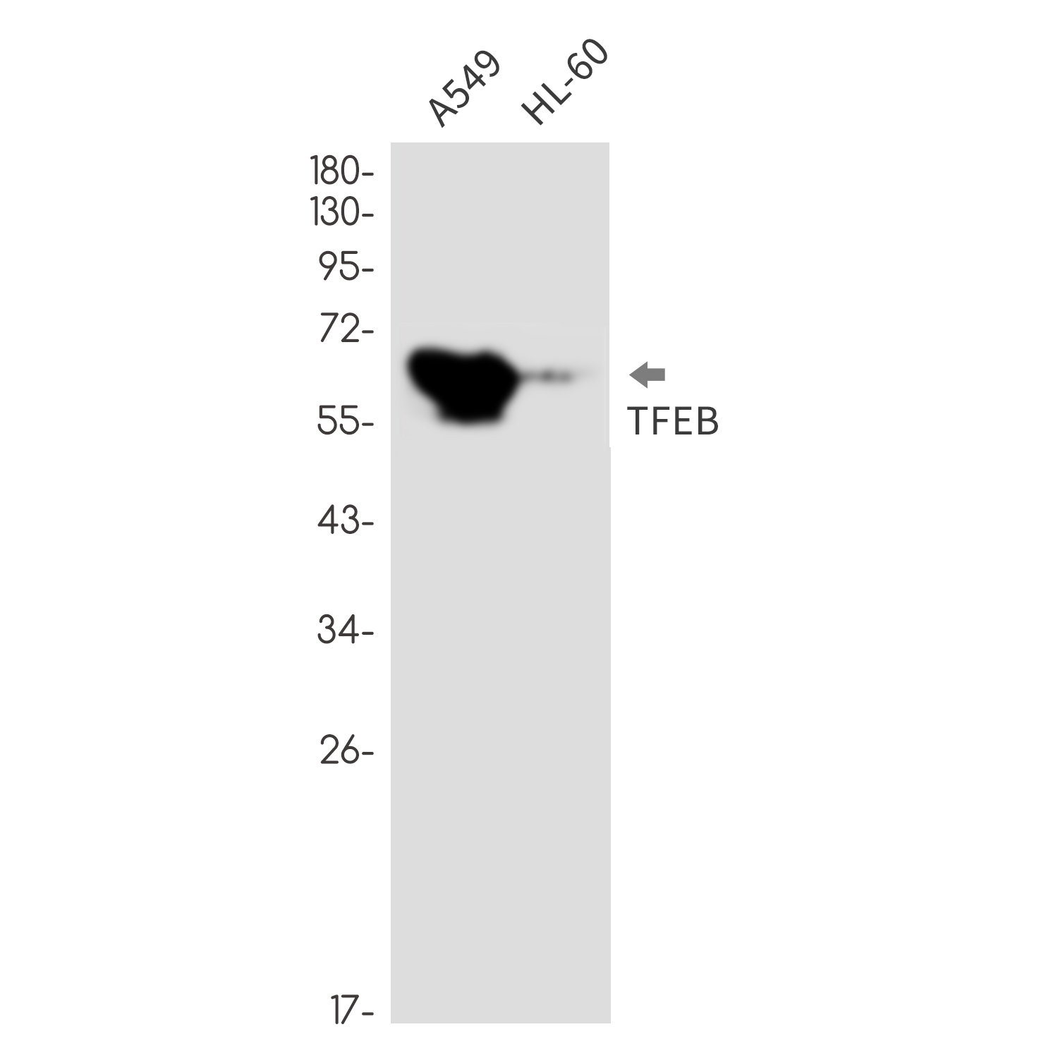 Transcription Factor EB Rabbit mAb