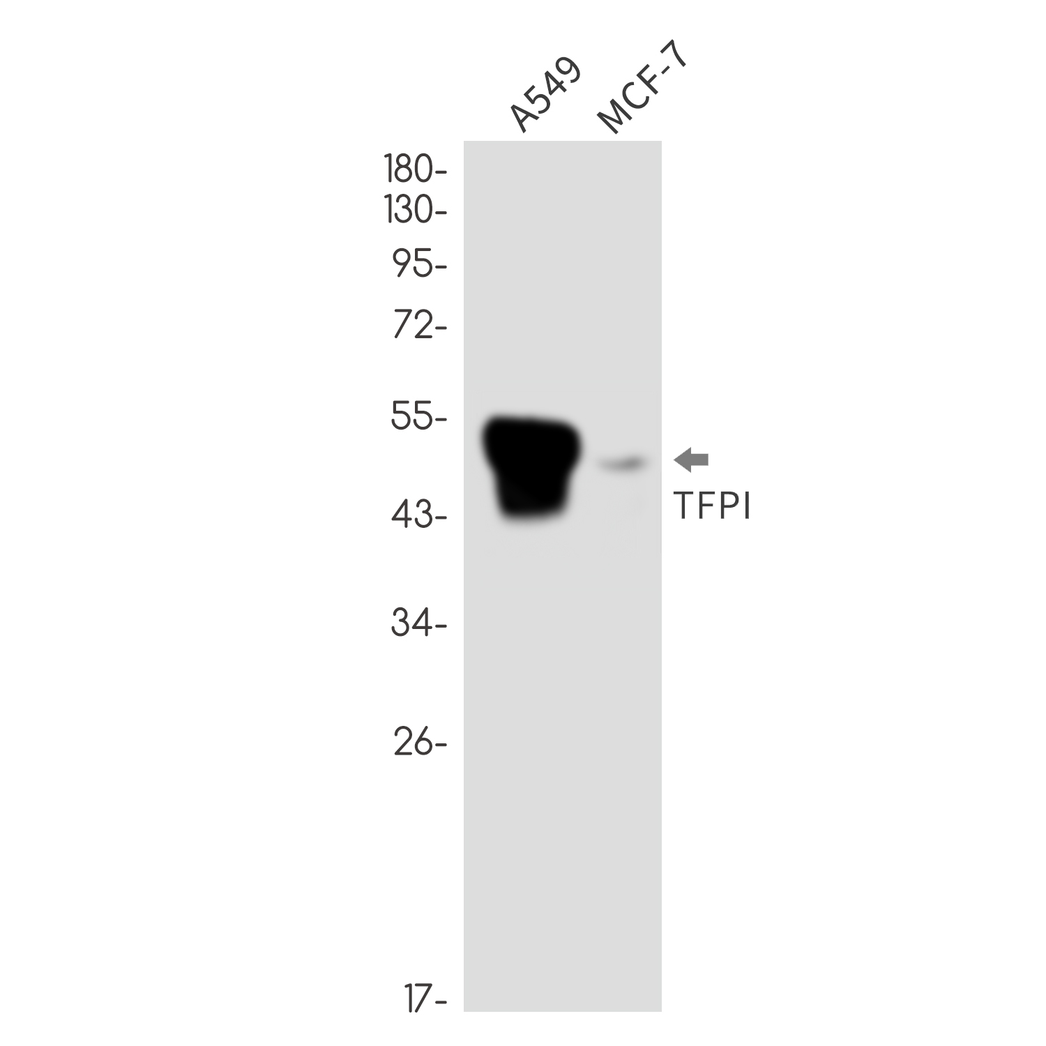 Tissue Factor Pathway Inhibitor Rabbit mAb