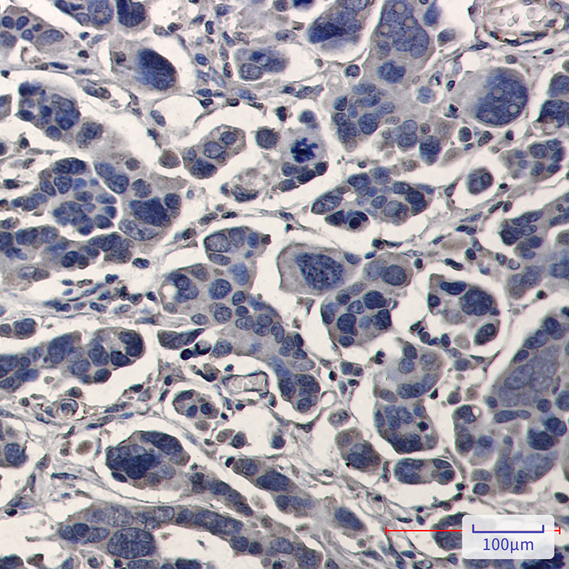 TPMT Rabbit mAb