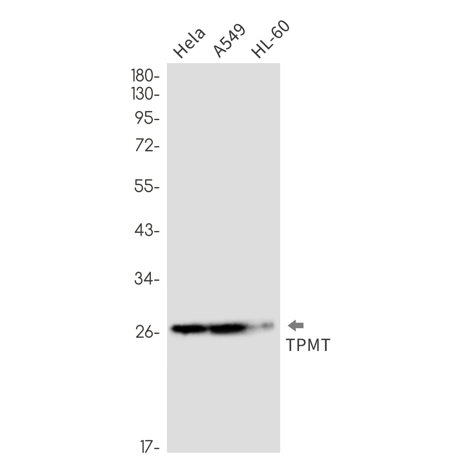 TPMT Rabbit mAb