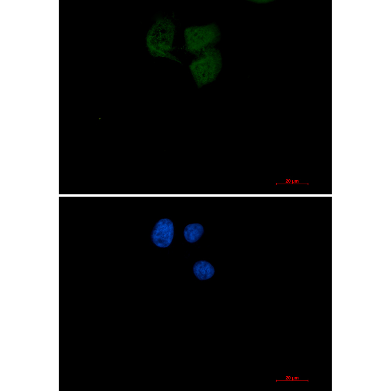 Ubiquitin Conjugating Enzyme E2 N Rabbit mAb