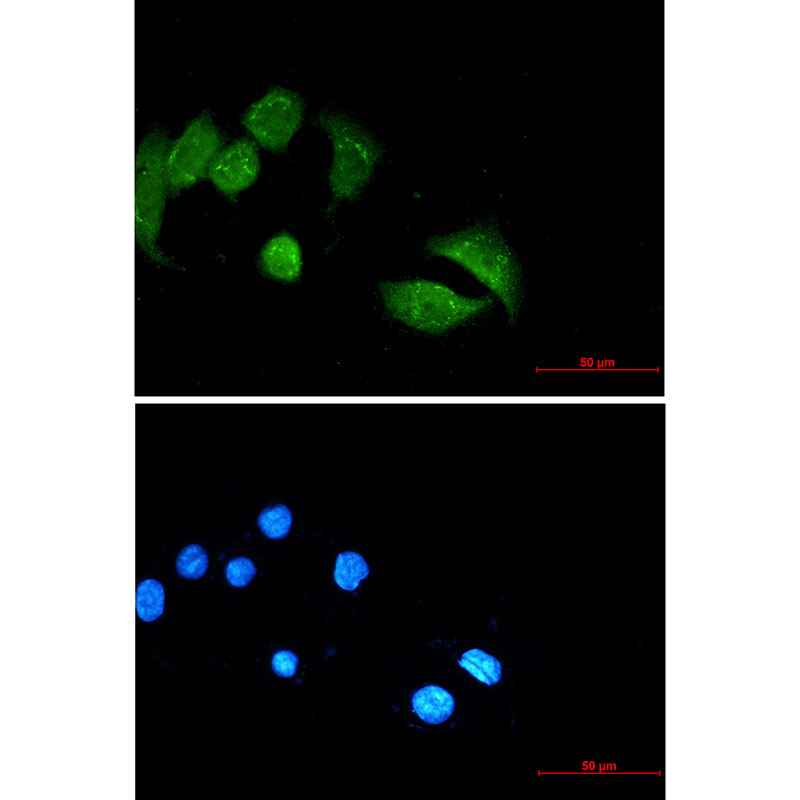 Ubiquitin Conjugation Factor E4 B Rabbit mAb
