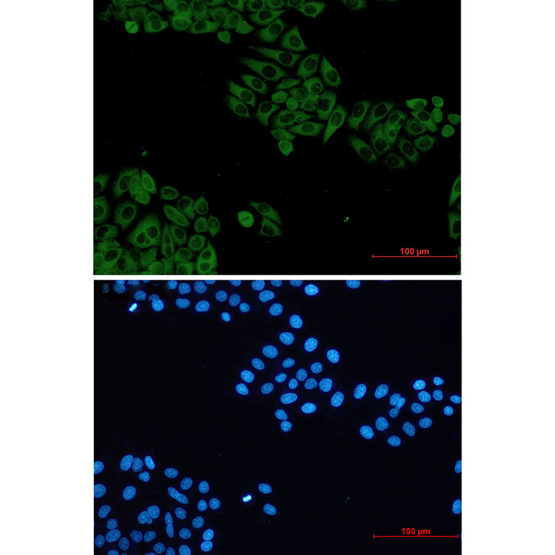 VAV2 Rabbit mAb