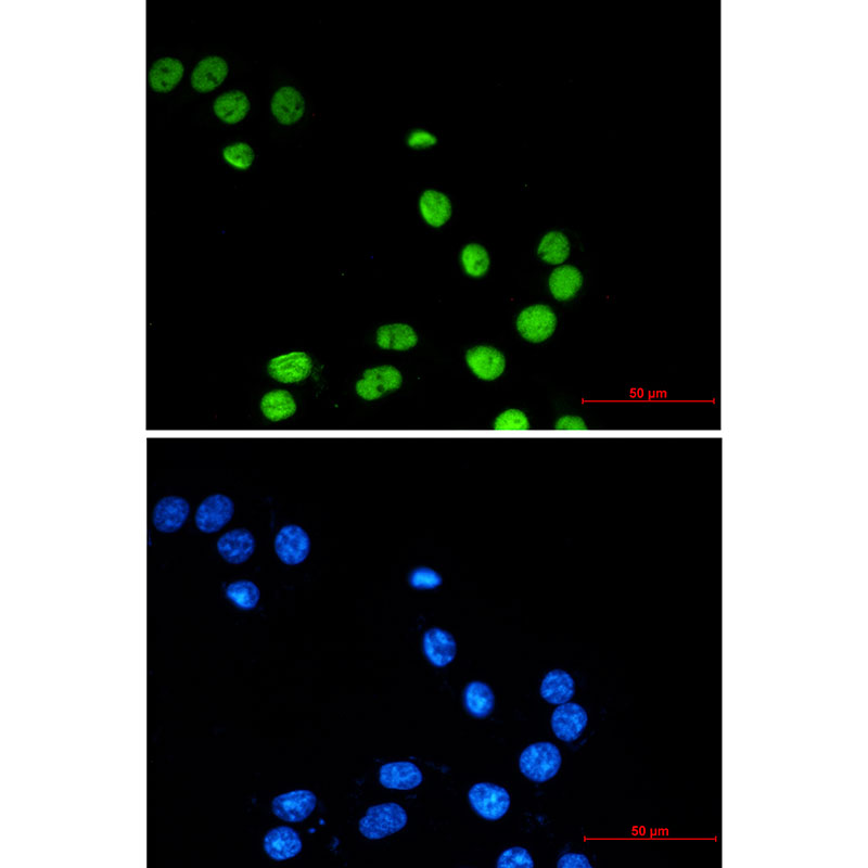 ZBTB7A Rabbit mAb
