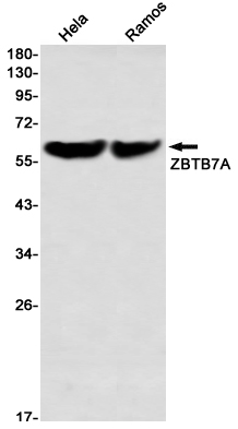 ZBTB7A Rabbit mAb
