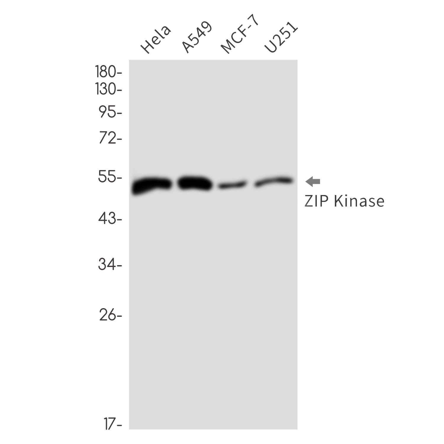 DAP kinase 3 Rabbit mAb