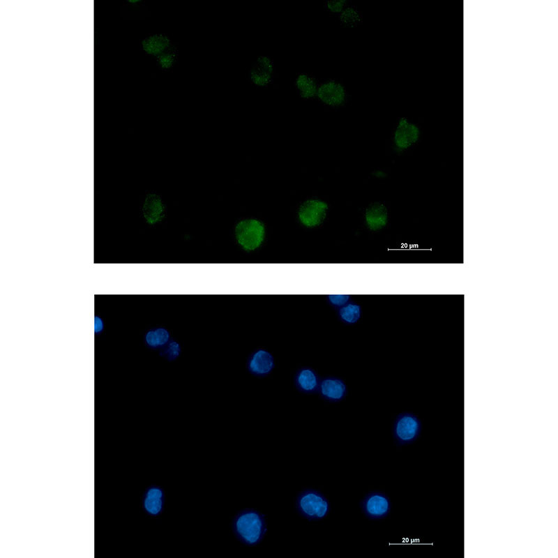 PKC beta 2 Rabbit mAb