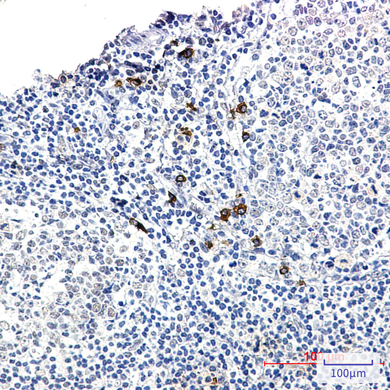 Human IgG4 Rabbit mAb