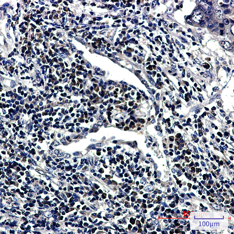 RING2 Rabbit mAb