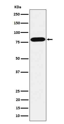 ABCD1/ALD Rabbit mAb 