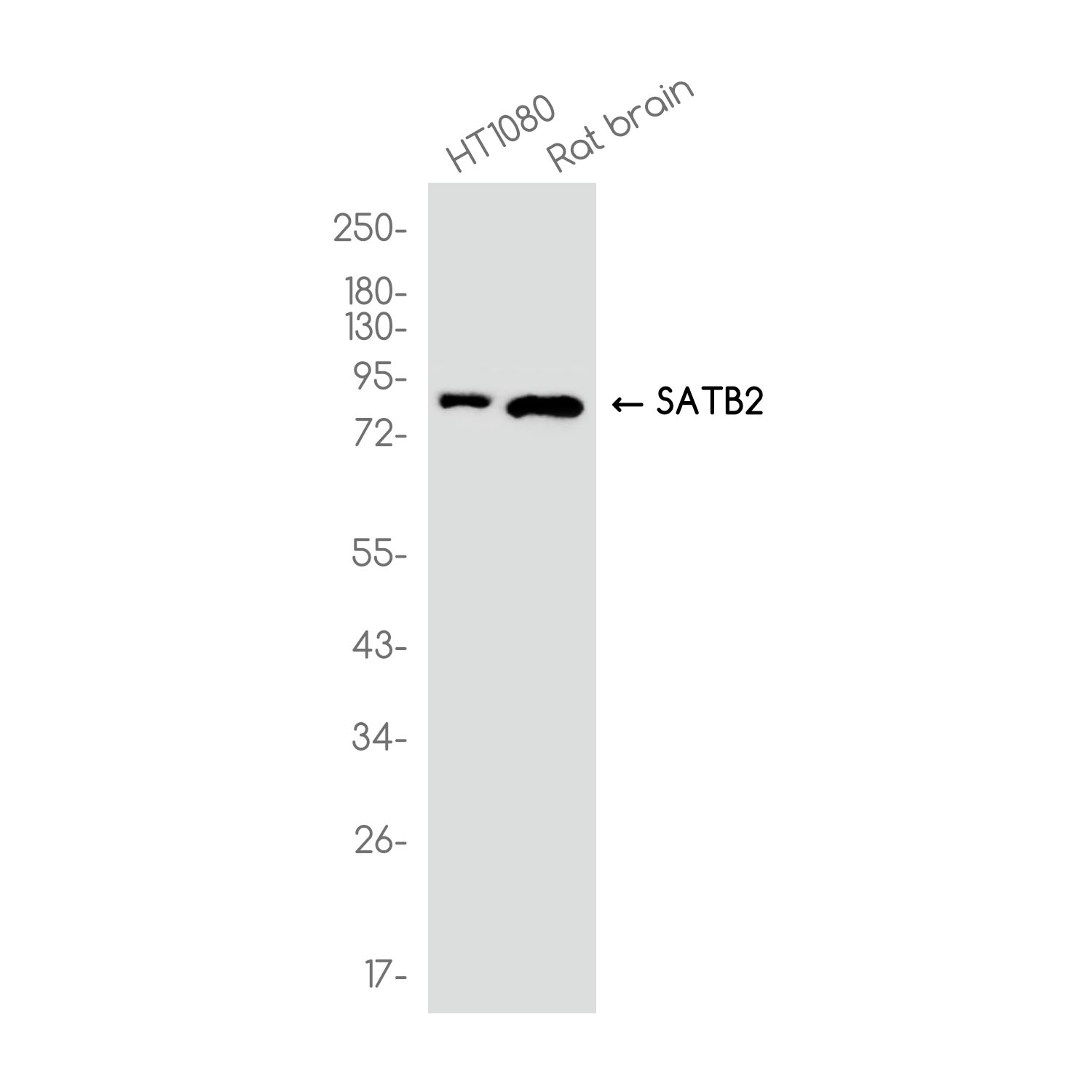 SATB2 Rabbit mAb