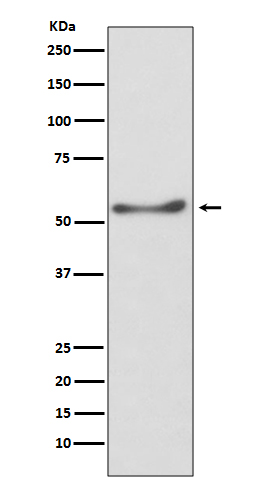 ATP5F1A Rabbit mAb