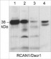 Anti-RCAN1/Dscr1 (C-terminus) Antibody