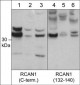Anti-RCAN1/Dscr1 (central region) Antibody