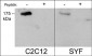 Anti-Robo2 (C-terminal region) Antibody