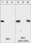 Anti-Sphingosine Kinase 1 (Central region) Antibody