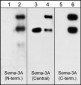 Anti-Semaphorin-3A (Central region) Antibody