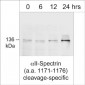 Anti-αII-Spectrin , cleavage-specific Antibody