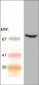 Anti-Syk (Central region) Antibody