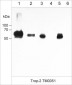 Anti-Trop-2/TACSTD2 (Extracellular region) Antibody