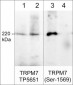 Anti-TRPM7 (Ser-1569), Phosphospecific Antibody