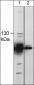 Anti-TRPM8 (Extracellular region) Antibody