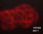 Anti-TRPM8 (Extracellular region) Antibody