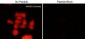 Anti-WAVE2 (Central region) Antibody