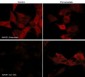 Anti-WAVE1 (Tyr-125), Phosphospecific Antibody