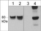 Anti-WAVE1 (Tyr-125), Phosphospecific Antibody