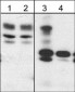 Anti-WAVE2 (Tyr-150) [conserved site], Phosphospecific Antibody