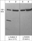 Anti-α-Actinin 4 (N-terminal) Antibody