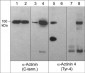 Anti-α-Actinin 4 (Tyr-4), Phosphospecific Antibody