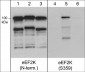 Anti-eEF2K (Ser-359), Phosphospecific Antibody