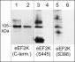 Anti-eEF2K (Ser-398), Phosphospecific Antibody