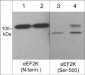 Anti-eEF2K (Ser-500), Phosphospecific Antibody
