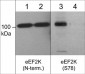 Anti-eEF2K (Ser-78), Phosphospecific Antibody