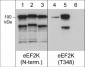 Anti-eEF2K (Thr-348), Phosphospecific Antibody