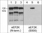 Anti-eEF2K (Ser-500), Phosphospecific Antibody