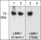 Anti-LIMK1 (Thr-508) [LIMK2 (Thr-505], Phosphospecific Antibody