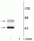 Anti-CaM Kinase II (Thr286) Antibody