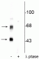 Anti-CaM Kinase II (Thr306) Antibody