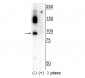 Anti-CtIP (Ser326) Antibody